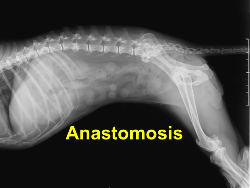 Read more about the article Anastomosis