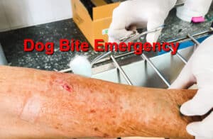 Dog bite emergency