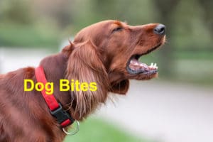 Read more about the article Statistics, Reasons, and Important Information Regarding Dog Bites